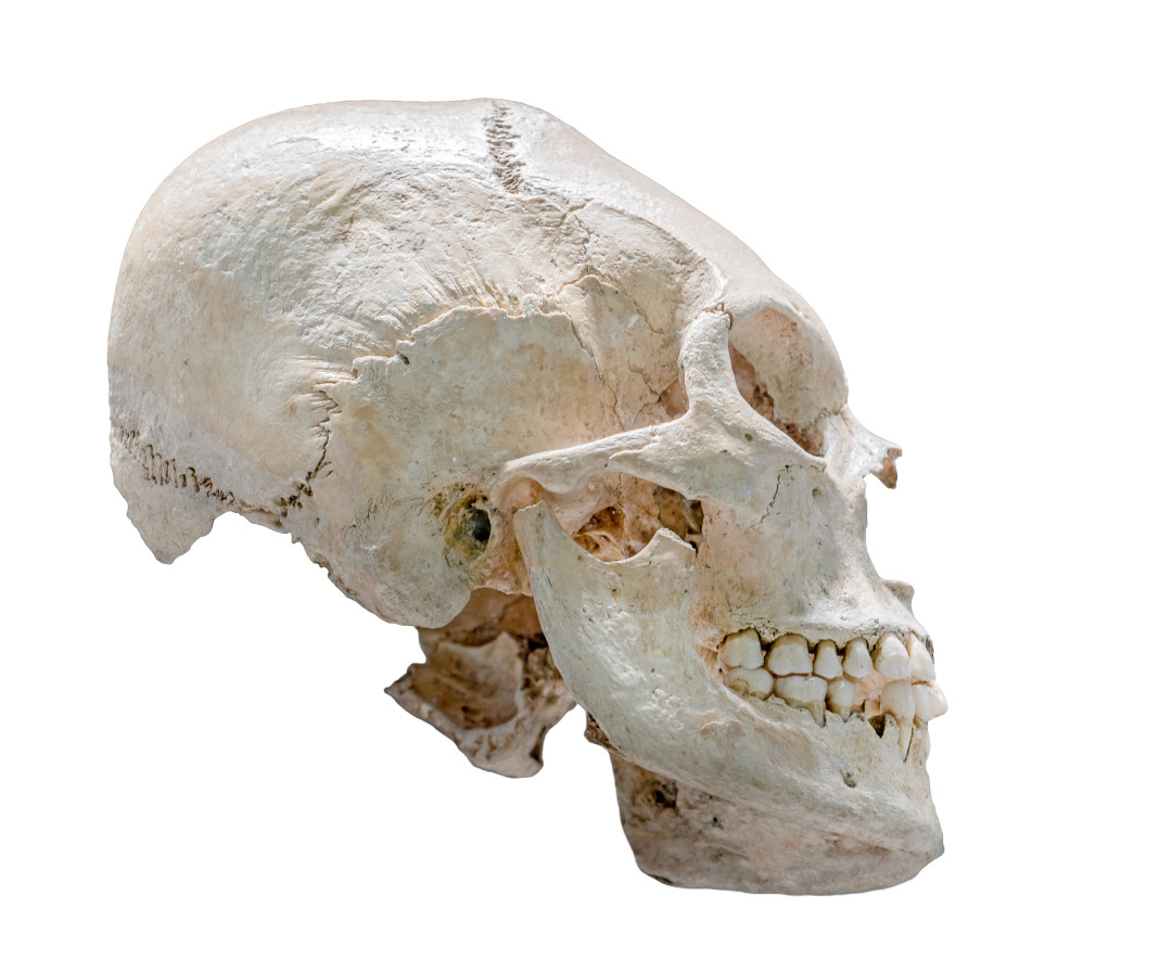 Страшно красиво: самые странные бьюти-тренды в истории