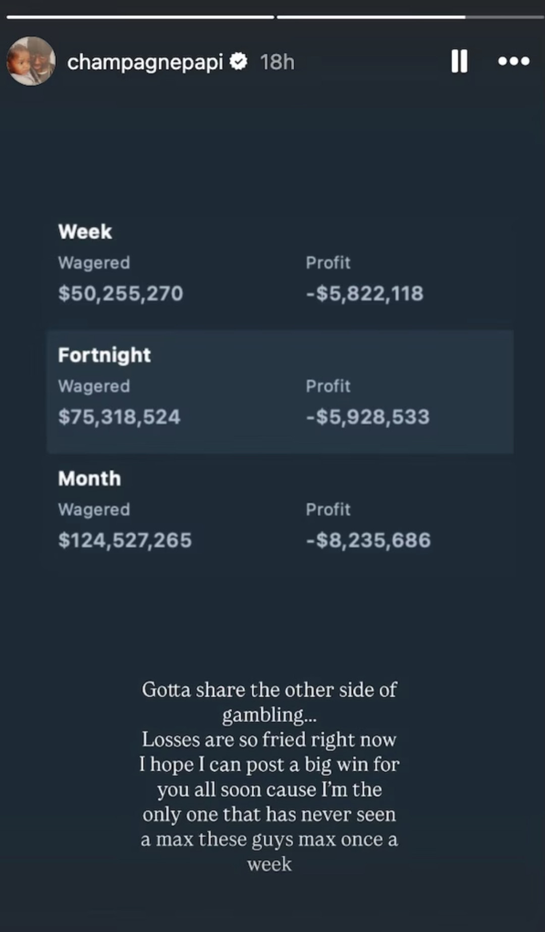 Дрейк потерял миллионы долларов из-за своей страсти 